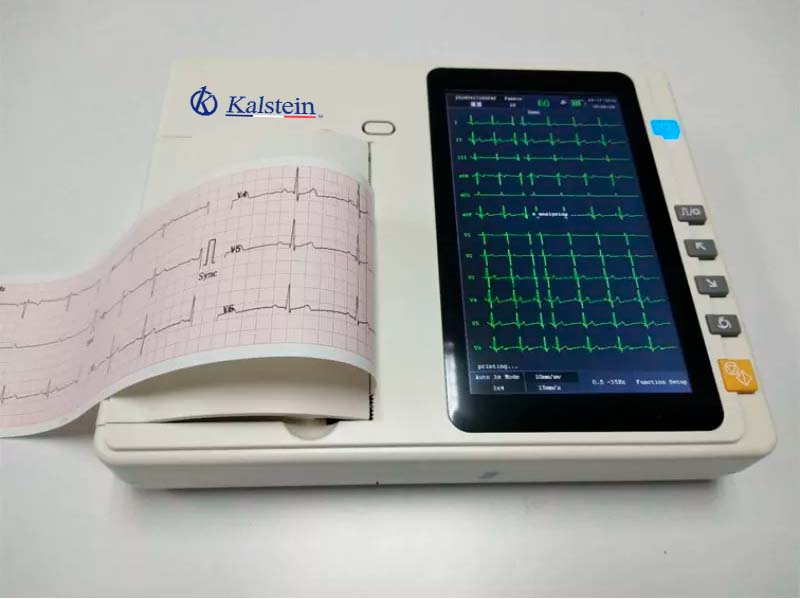 What is the role of the ECG?