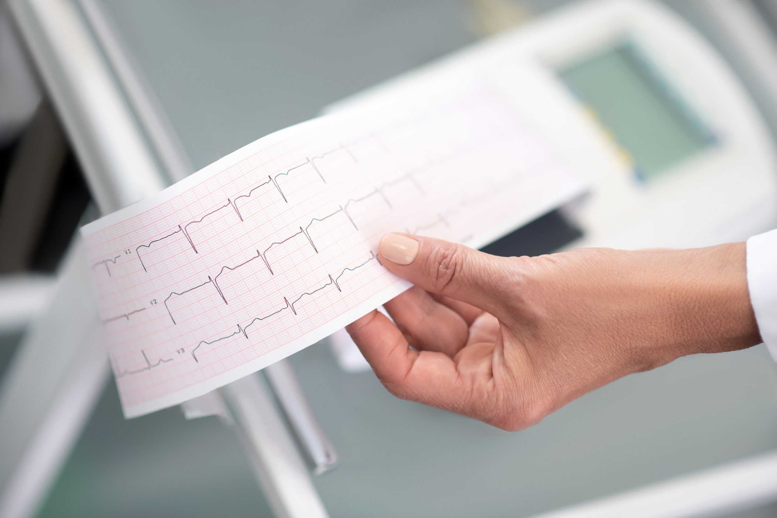 Using the Electrocardiogram to Predict Pericarditis