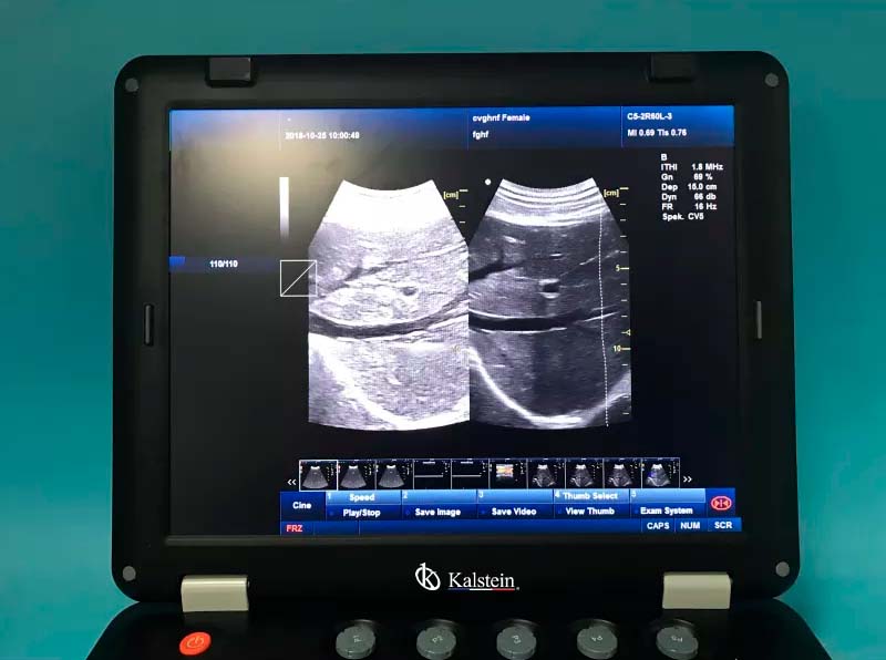 128 Item 3D Medical THI Ultrasound Machine For Sale With Convex Probe YR05148 – 2