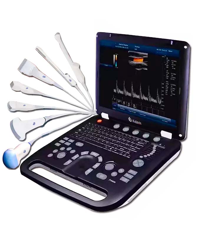 Ultrasound Scanner: Hoge-Definitie Beelden voor Precieze Diagnoses